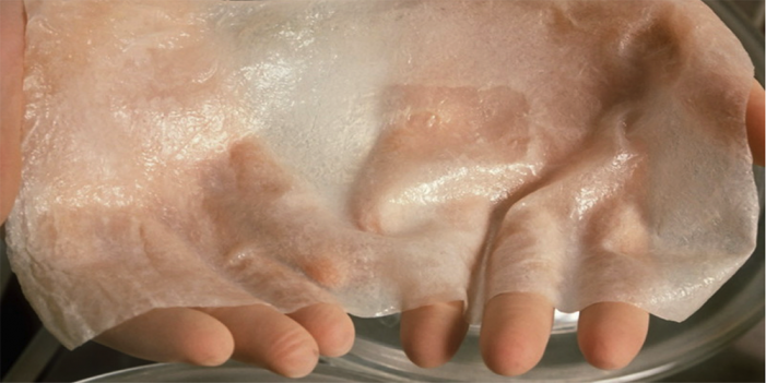 Regeneran epidermis humana gracias a células madre transgénicas